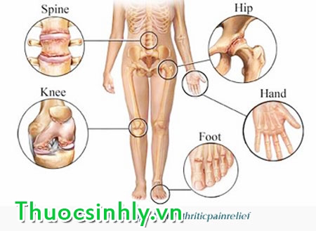 glucosamine-1500mg-2