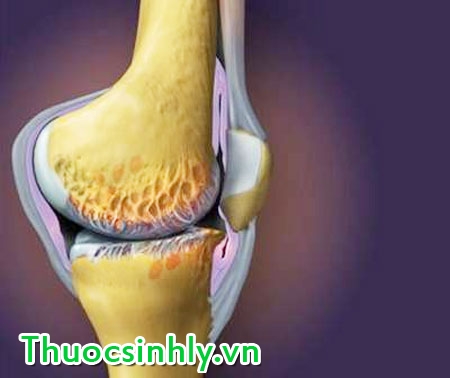 nen-su-dung-glucosamin-the-nao-cho-dung