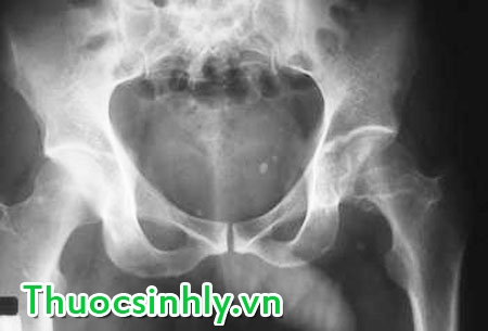 trieu-chung-man-duc-nam-2