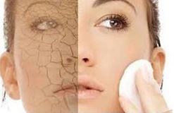 9 cách hữu hiệu ngăn chặn da khô